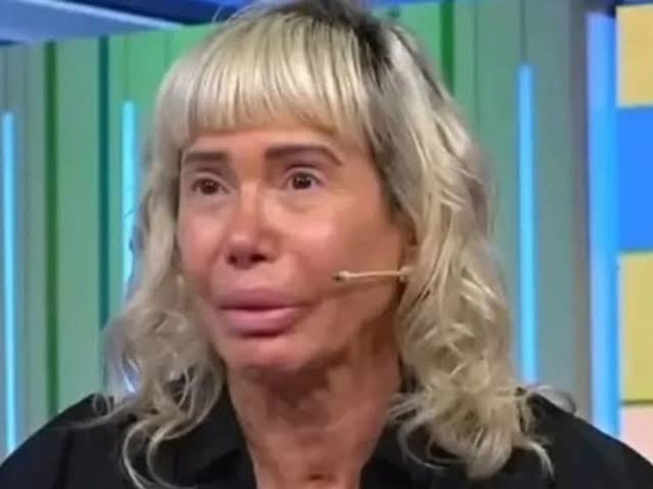 Famosas que se operaron con Aníbal Lotocki