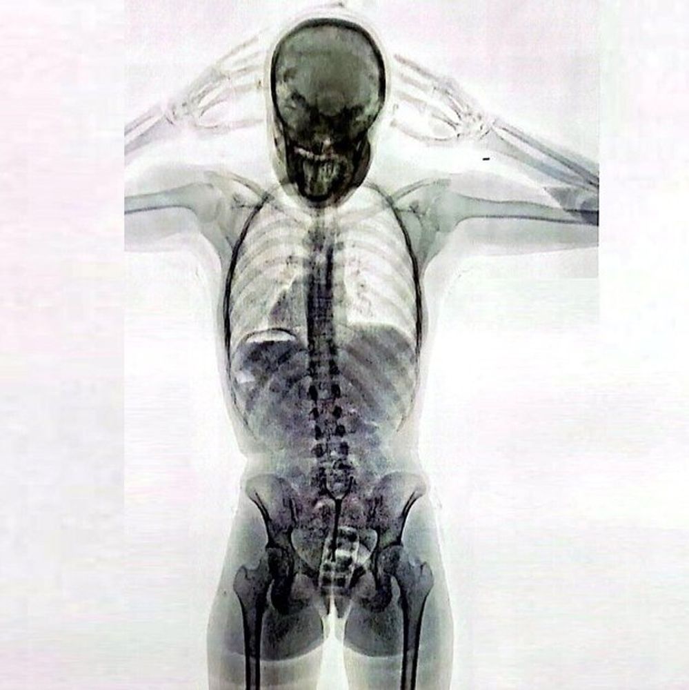La mujer argentina, de 30 años, ocultó la cocaína en su cuerpo.