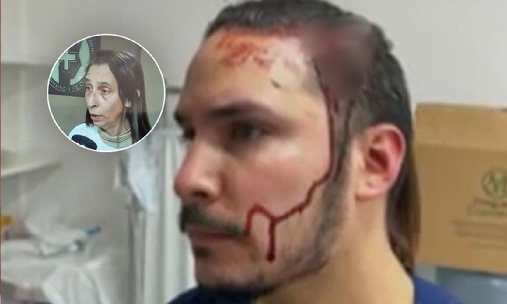 El veterinario que fue brutalmente atacado.