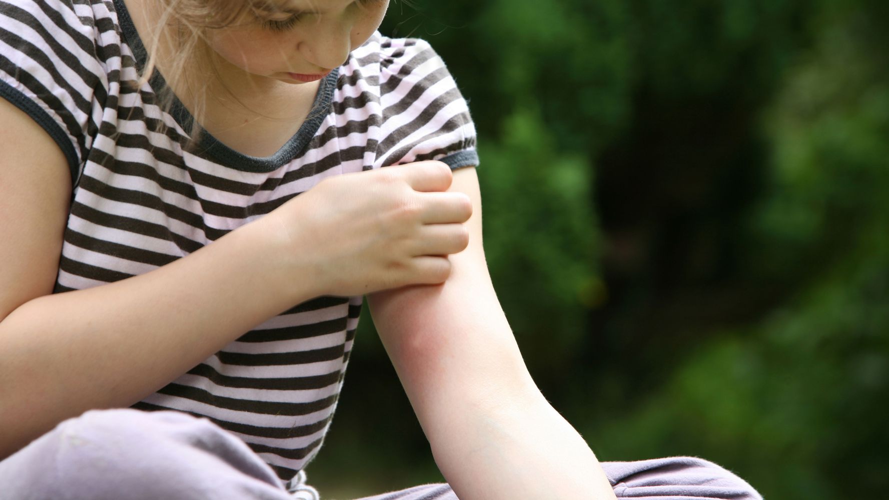 Cómo "eligen" los mosquitos a quién picar.