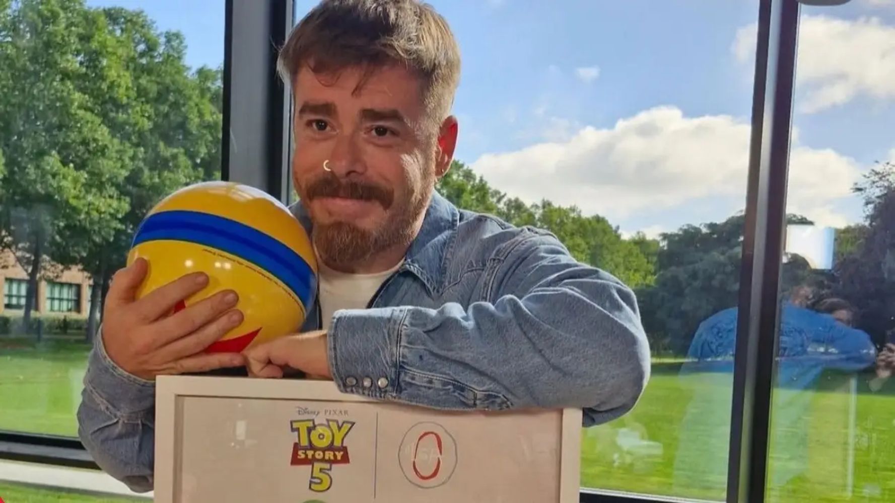 Migue Granados confesó sus inseguridades físicas pese a bajar de peso