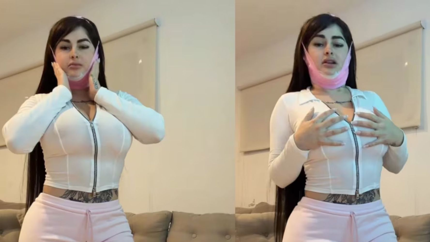 Kami Franco mostró los resultados de su cirugía.