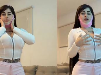 Kami Franco se hizo tres retoques en el rostro y mostró el resultado: qué se realizó