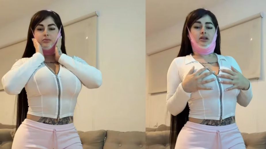 Kami Franco se hizo tres retoques en el rostro y mostró el resultado: qué se realizó