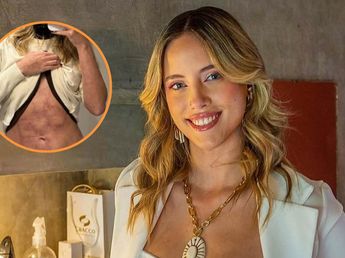 Denisse González, exGH, contó cómo es su nuevo tratamiento y mostró las secuelas en su cuerpo: "Venom"
