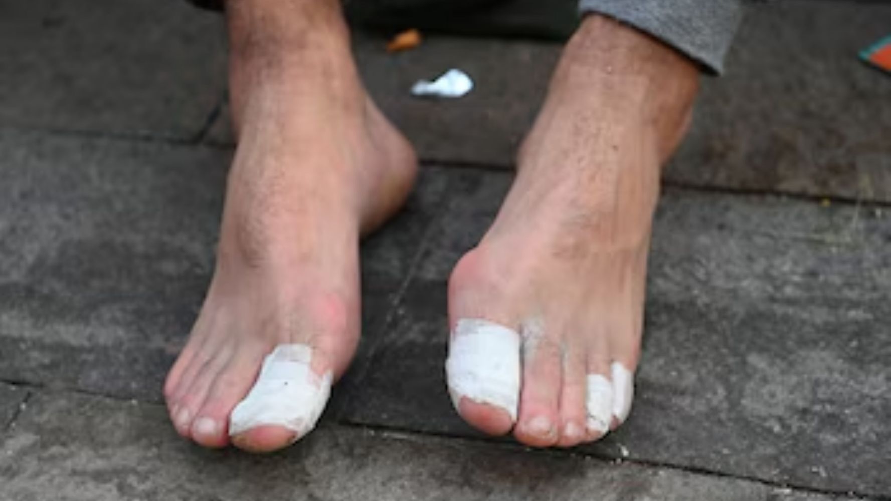 Las claves para no lastimarse los pies.