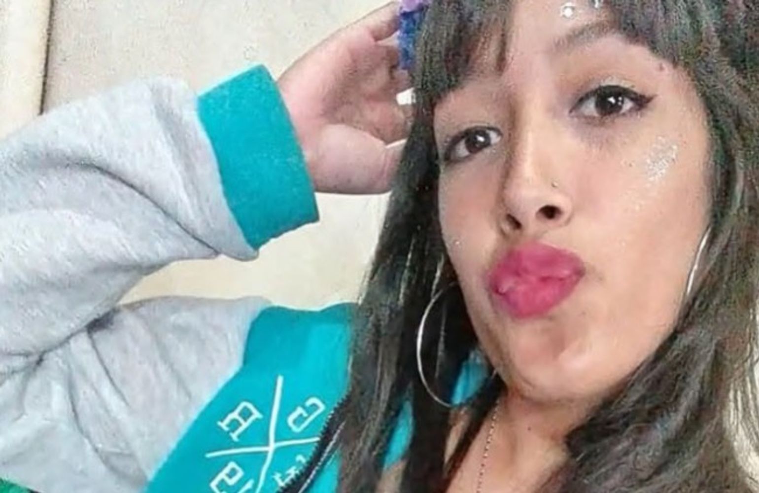 La joven fue atacada con ácido.