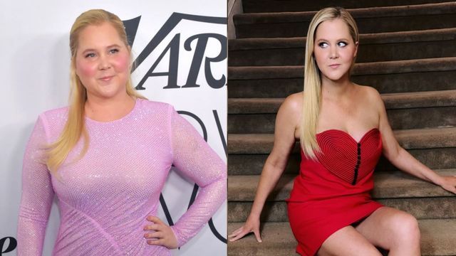 Amy Schumer.