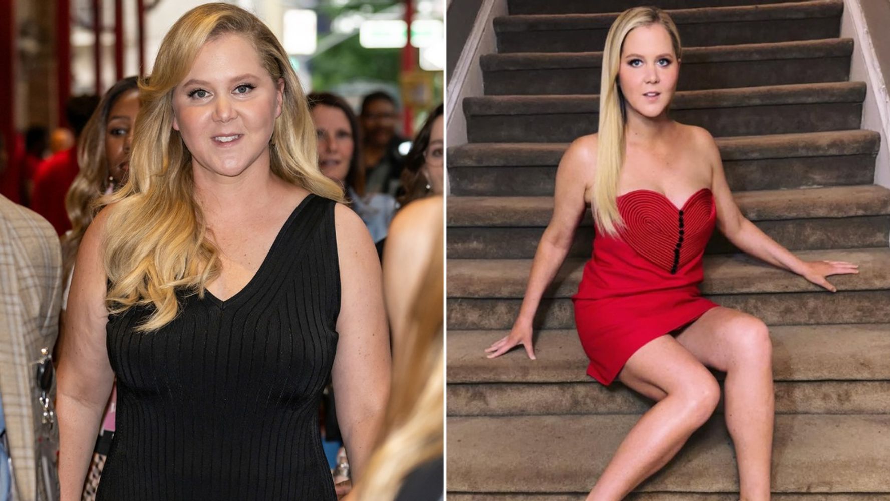 Amy Schumer antes y después.