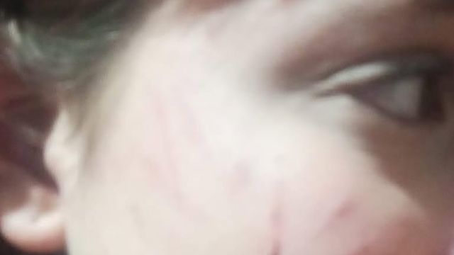 Dos adolescentes desconocidas la habrían agredido, según el relato de la madre. Los motivos se investigan.
