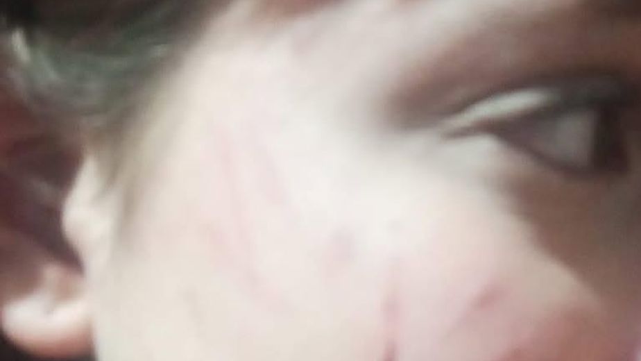 Dos adolescentes desconocidas la habrían agredido, según el relato de la madre. Los motivos se investigan.