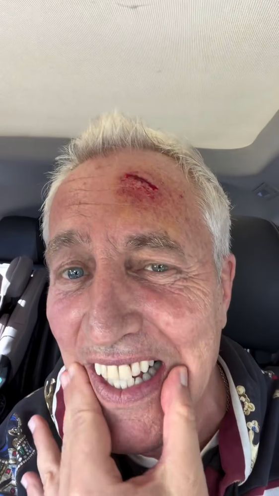 El accidente de Marley