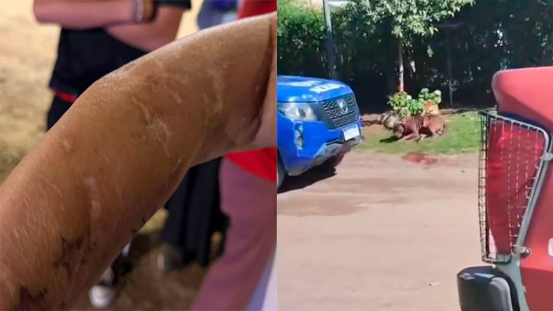 Las imágenes del ataque del pitbull en Villa Allende.