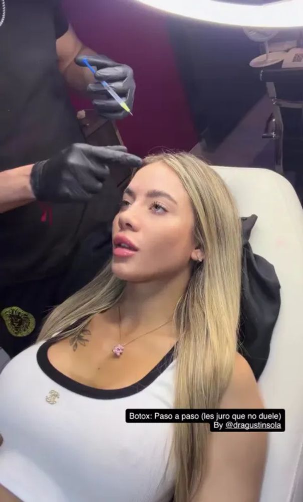 Candela Arizaga mostró el retoque estético que se hizo a los 23 años