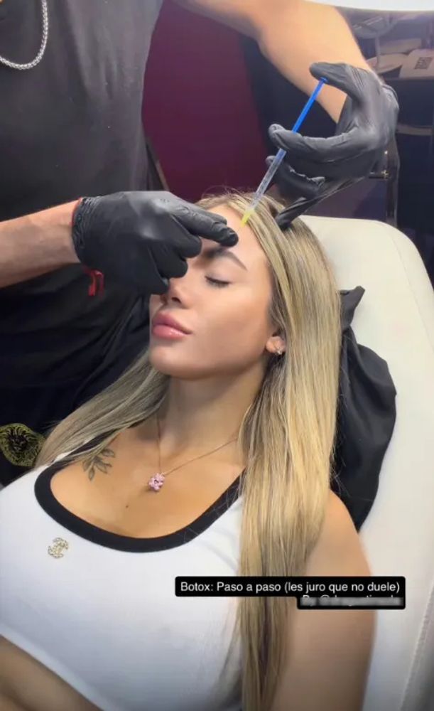 Candela Arizaga mostró el retoque estético que se hizo a los 23 años