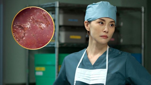 Una escena de la serie médica de Netflix generó comparaciones con un caso real ocurrido en el Reino Unido.