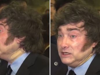 Por qué Javier Milei apareció con un vendaje en el cuello: la versión del entorno del presidente