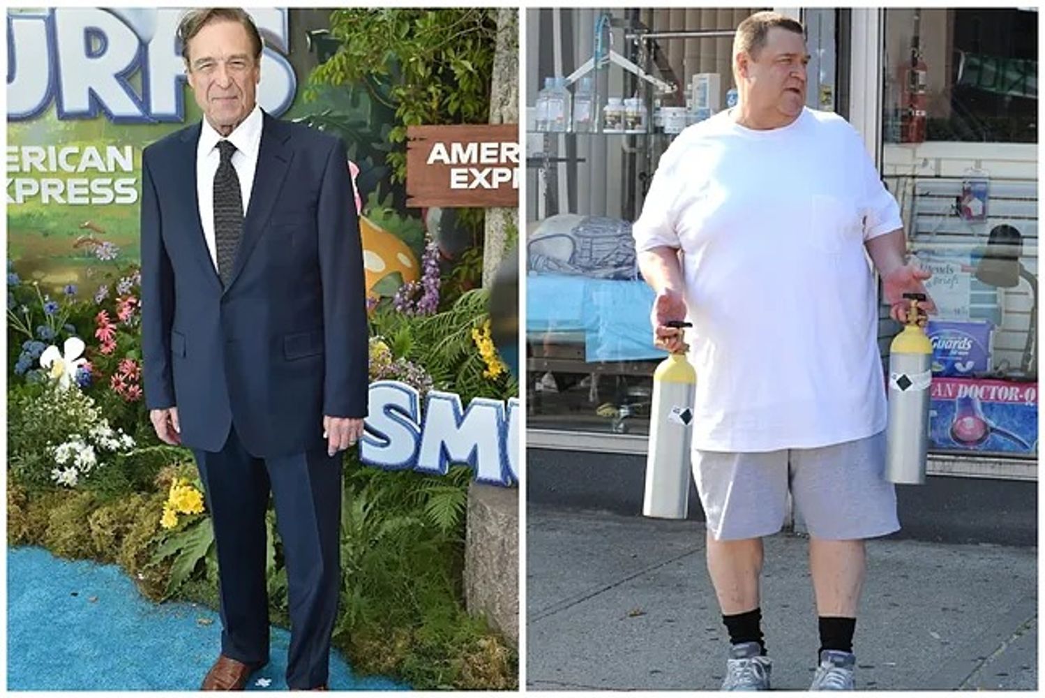 John Goodman contó que se sometió a una cirugía de estómago para acompañar su proceso de pérdida de peso.