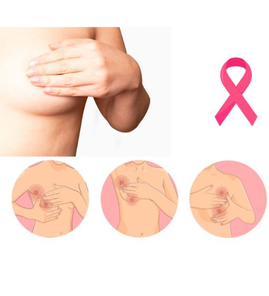 Cáncer de mama  