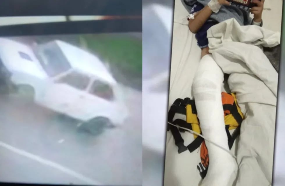 Un conductor atropelló a un niño en La Plata y se dio a la fuga.