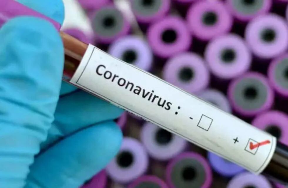 Coronavirus positivo