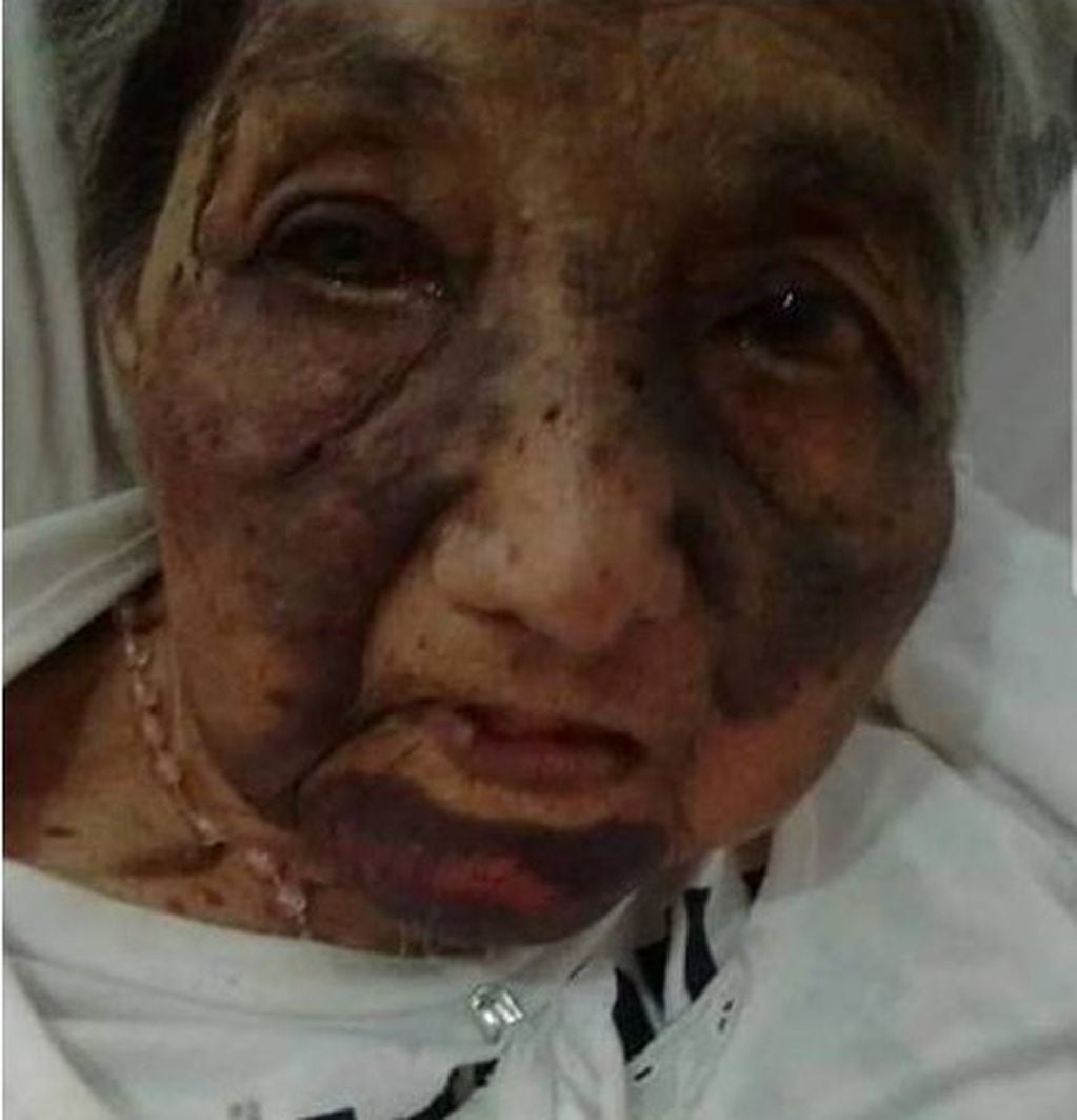 Una abuela fue agredida salvajemente por delincuentes. (Aire de Santa Fe)