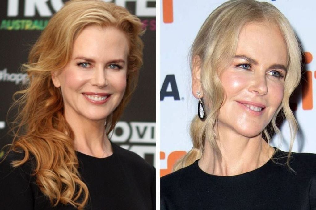 Nicole Kidman en el 2012 y la actualidad