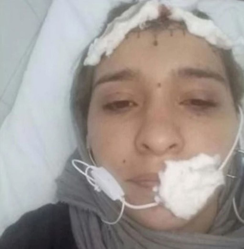 Julia Leal en el Hospital San Bernardo de la ciudad de Salta, tras haber sido golpeada.