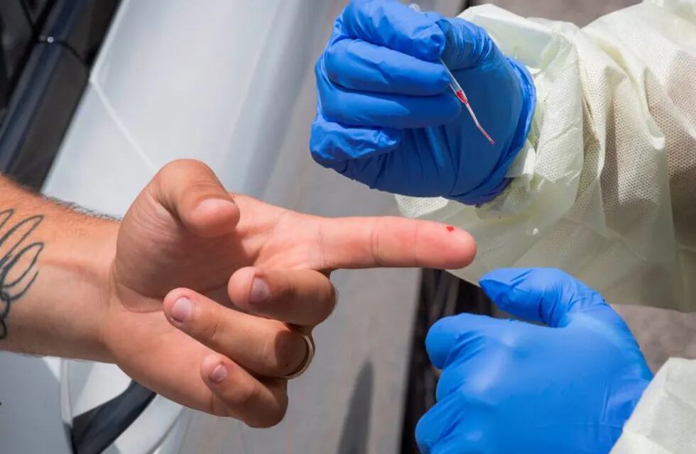 Medical staff from myCovidMD provide free COVID-19 virus antibody testing in observance of Juneteenth at the Faith Central Bible Church, in the predominately African American city of Inglewood, California on June 19, 2020 (Photo by Mark RALSTON / AFP)  test rapido anticuerpos serologico