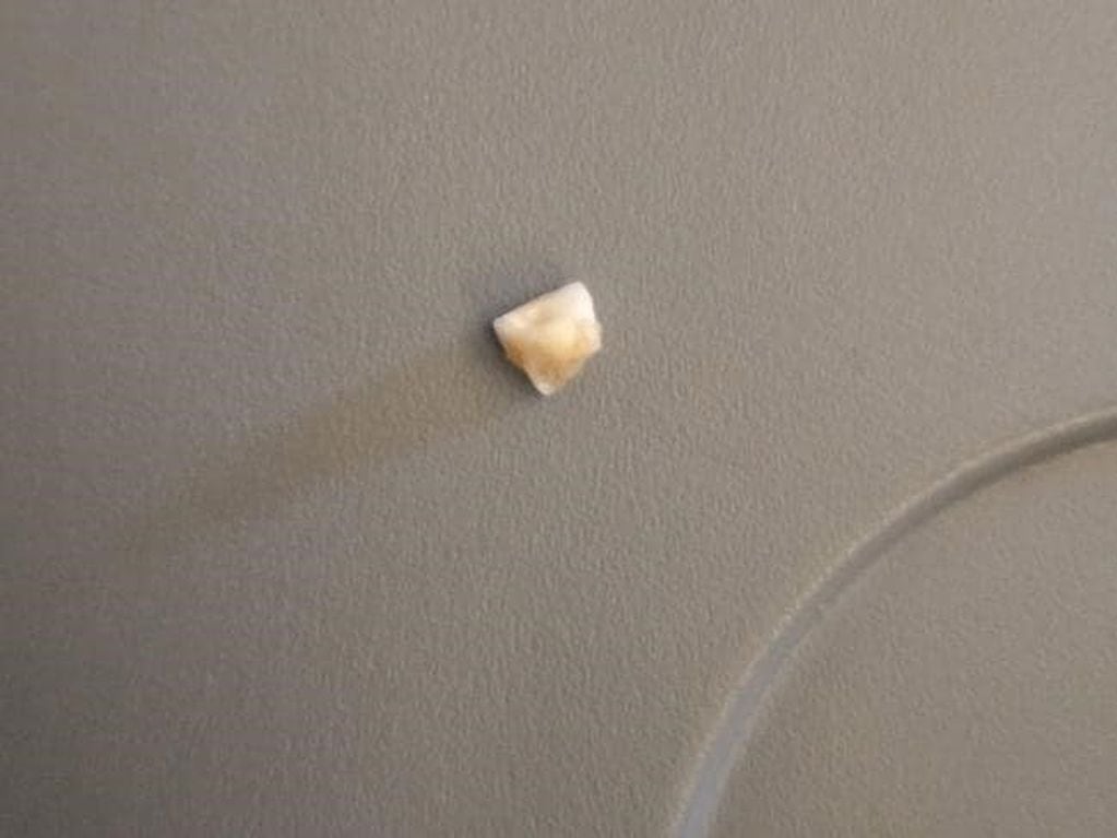 Un pasajero de Singapore Airlines encontró un diente en su comida.
