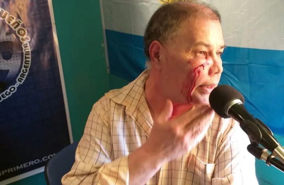 Tlemo Benitez, periodista de Tolhuin agredido salvajemente.