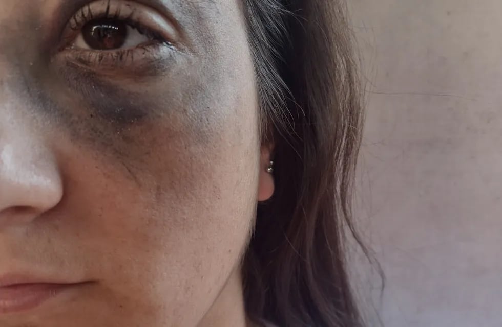 Yésica Brusa denunció que fue fuertemente golpeada por un efectivo policial.