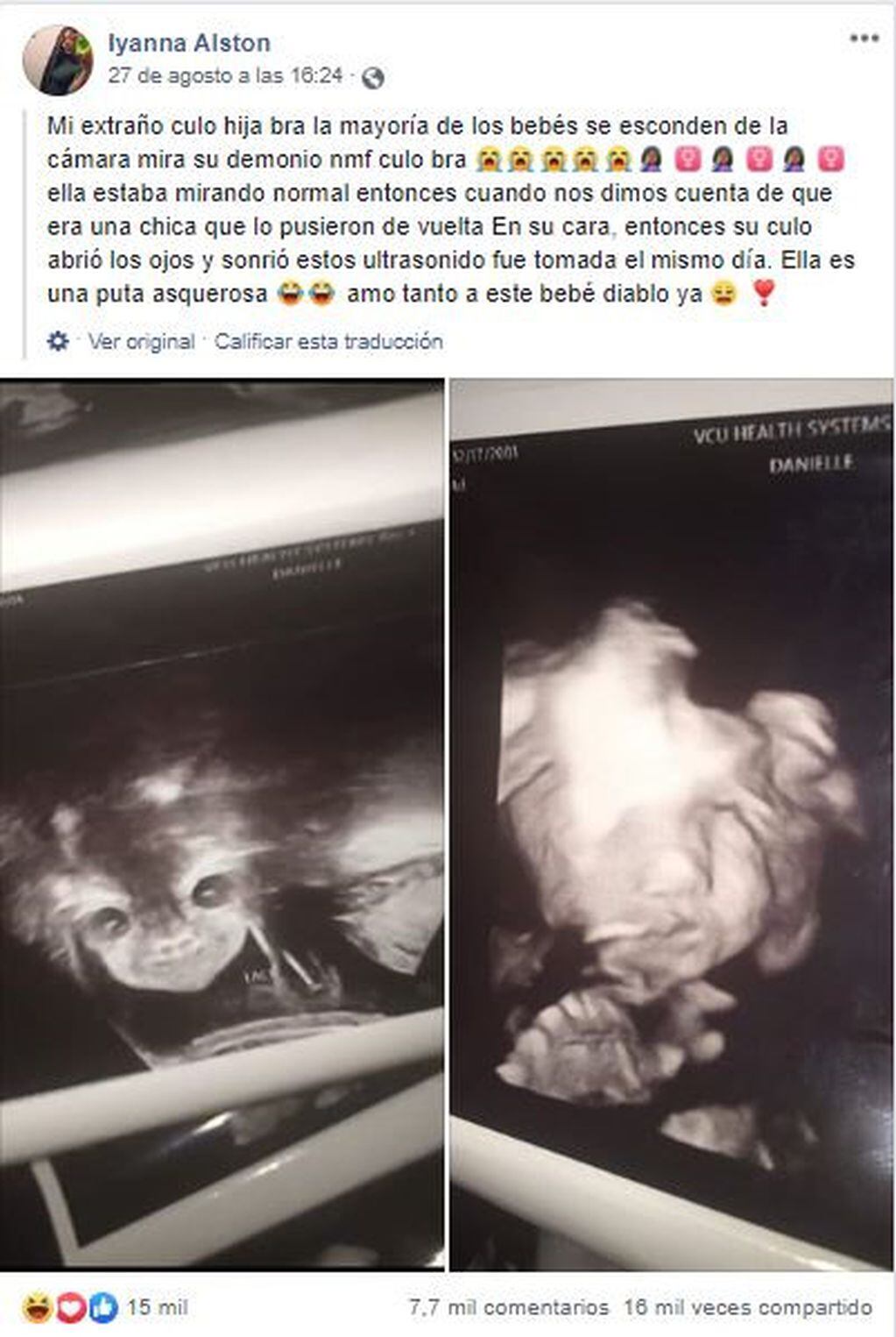 Se hizo una ecografía y se horrorizó al notar que su bebé tenía cara diabólica (Foto: Facebook)