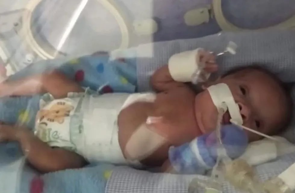 Josafat, el bebé prematuro que necesita de todos para tener su hogar en Fray Luis Beltrán.