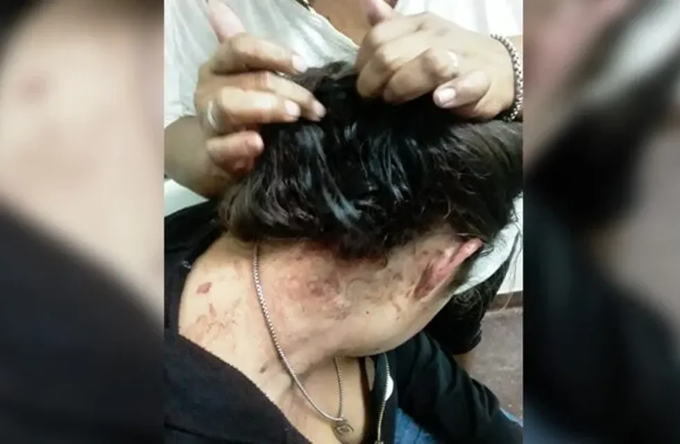 Violencia de género en Posadas terminó con una mujer asistida.
