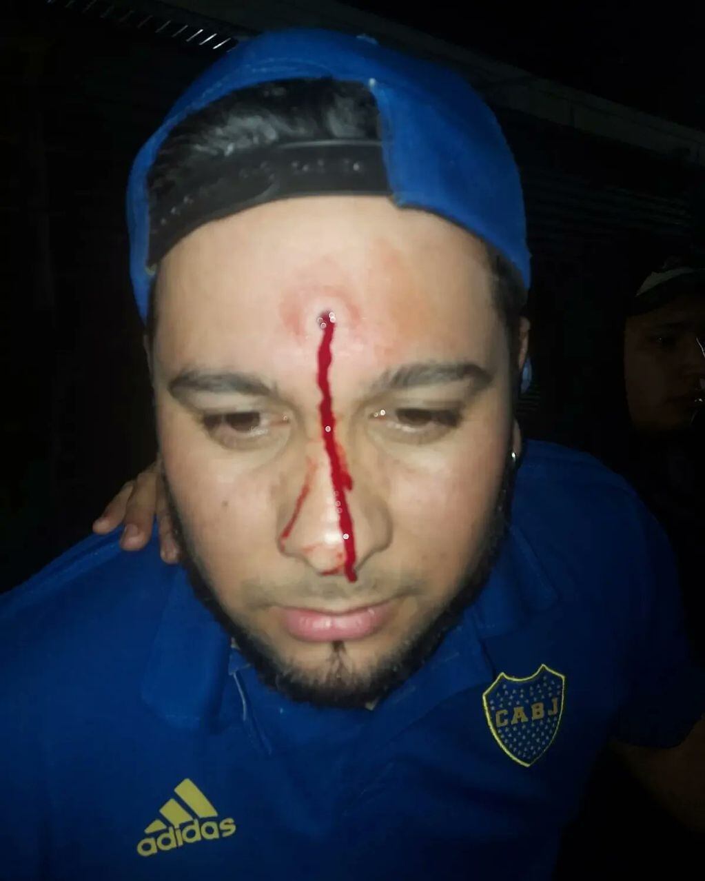 Imágenes sensibles. un cantante de cumbia fue herido con un rifle de aire comprimido.