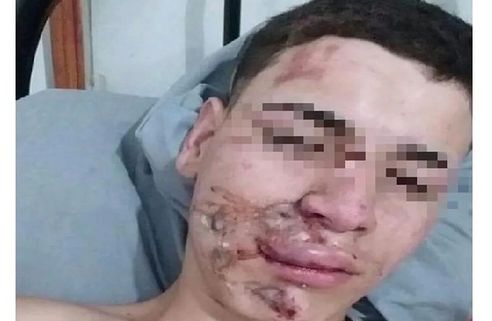 El joven sufrió lesiones en el rostro.
