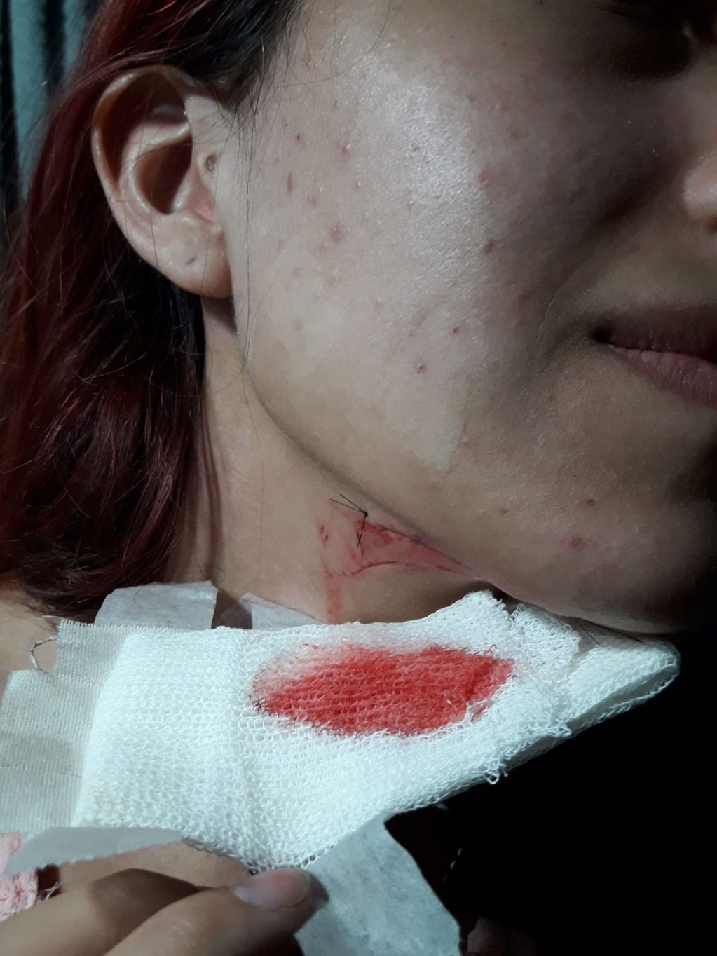 Joven herida por motochorros. Foto: Radio Máxima