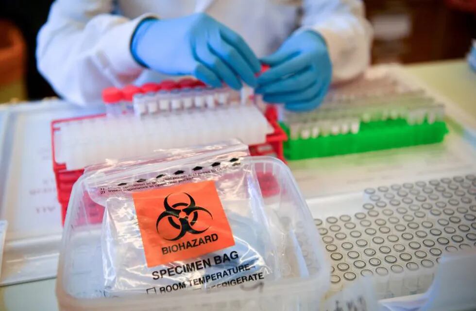 10 March 2020, Wales, Cardiff: Lab technicians handle suspected COVID-19 samples as they carry out a diagnostic test for coronavirus in the microbiology laboratory inside the Specialist Virology Centre at the University Hospital of Wales. Photo: Ben Birchall/PA Wire/dpa
