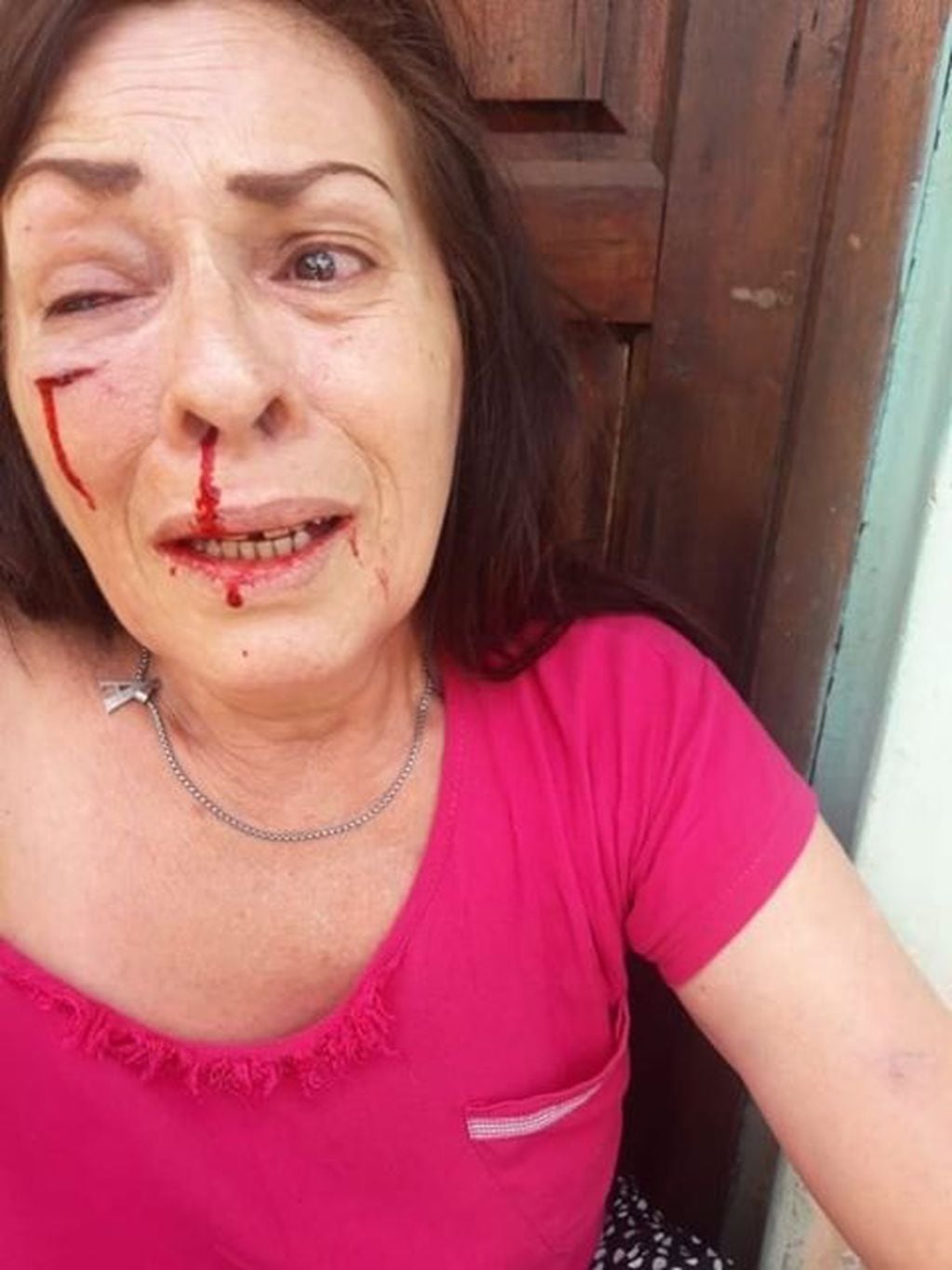 Lucía Fernández fue golpeada brutalmente por su cuñado a raíz de una pelea familiar por un terreno. (Misiones Online)