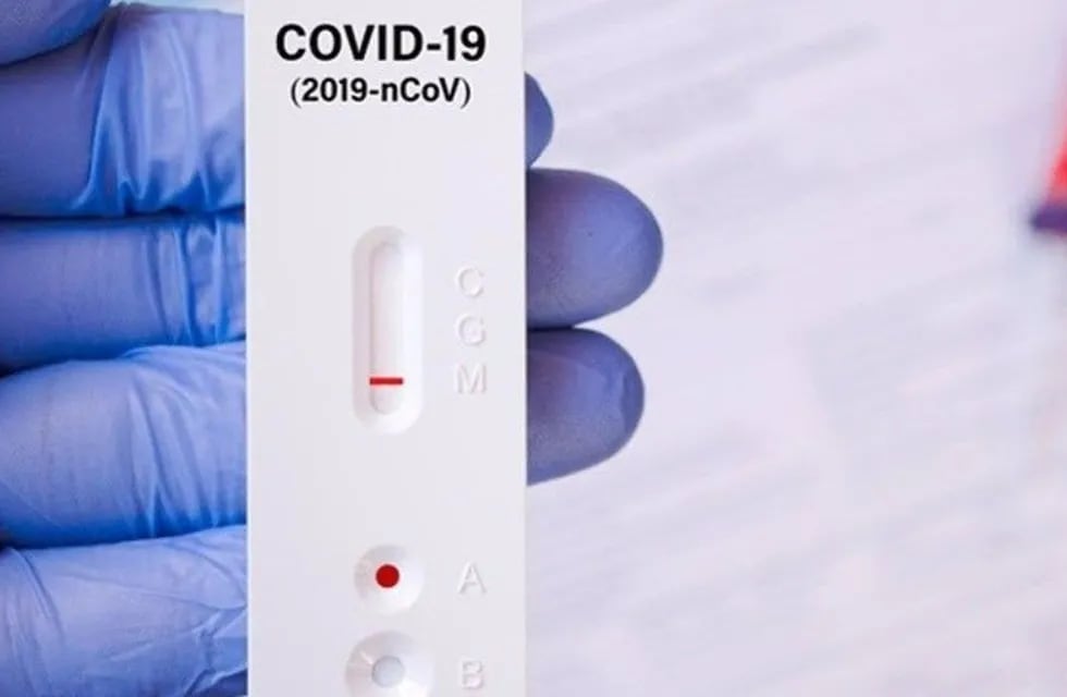 Autotest para detectar coronavirus