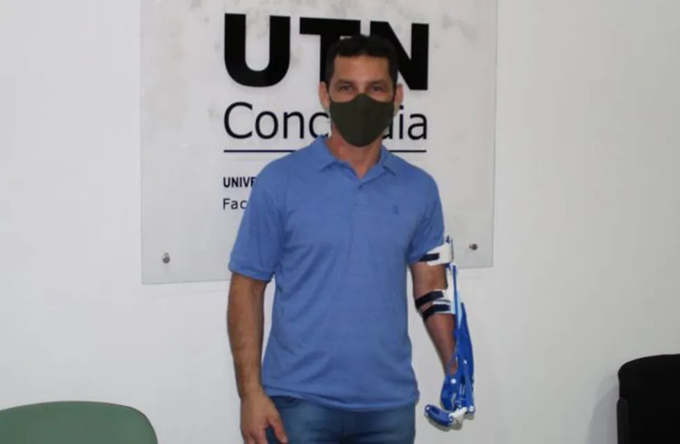 La prótesis fue entregada a Luciano Ruiz Díaz