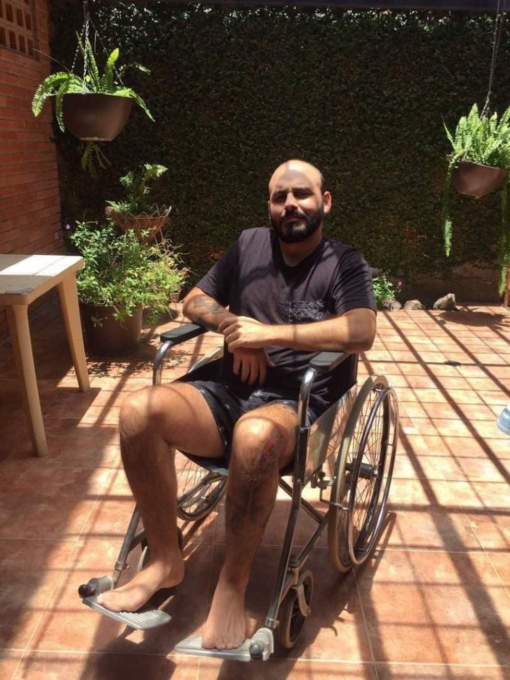 Pedro Leonardo Jiménez, el argentino que vive en Venezuela pero no puede acceder a la quimioterapia para tratarse el cáncer que padece.