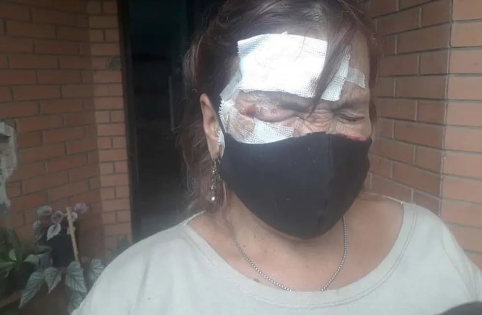 Mujer atacada a golpes en Concordia