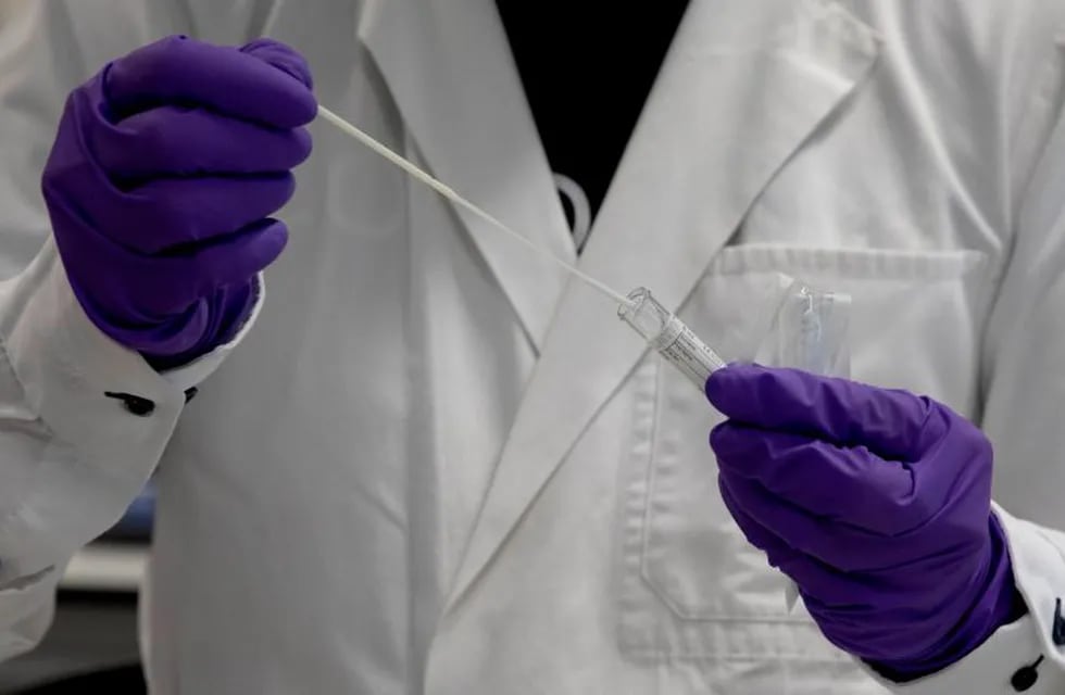 A lab technician inserts a nasal swab into a test tube during research on coronavirus, COVID-19, at Johnson & Johnson subsidiary Janssen Pharmaceutical in Beerse, Belgium, Wednesday, June 17, 2020. Janssen Pharmaceutical hopes to begin clinical trials on a potential vaccine for COVID-19 in the middle of the summer. (AP Photo/Virginia Mayo)