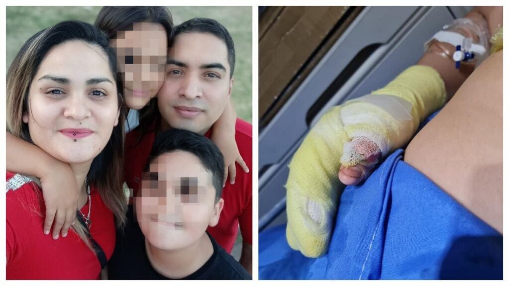 La desesperada lucha de la mamá de Tahiel, el nene que se quemó en una Feria de Ciencias en La Matanza.