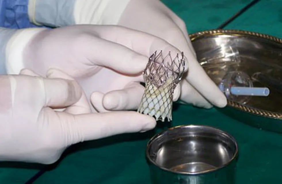 Se llevó a cabo un implante aórtico en Comodoro