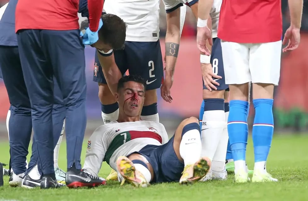 Cristiano Ronaldo quedó sangrando por un duro golpe. Foto: Reuters