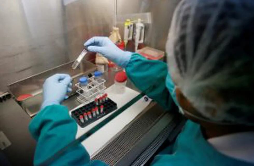 A health technician analyses blood samples for tuberculosis testing in a high-tech tuberculosis lab in Carabayllo in Lima, Peru May 19, 2016. REUTERS/Mariana Bazo SEARCH 