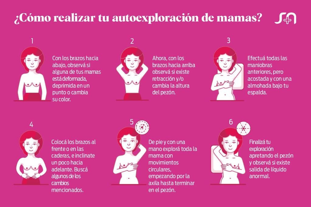 ¿Cómo realizar tu autoexploración de mamas? Foto: Sanatorio Allende